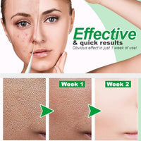 Thumbnail for ZeroPore Instant Perfection Serum - thedealzninja