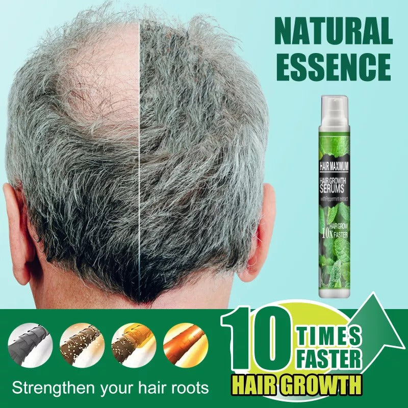 Herbal Hair-Growth Essence Spray - thedealzninja