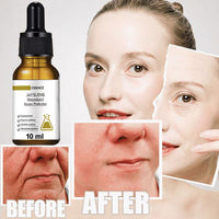 Thumbnail for 2022 New Instant Perfection Wrinkles Essence - thedealzninja