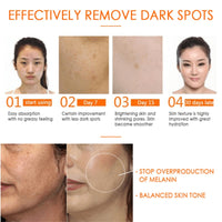 Thumbnail for Anti Dark Spots Vitamin C Oil - thedealzninja