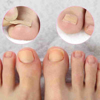 Thumbnail for Glue Free Toenail Patch - thedealzninja