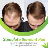 Thumbnail for 7X Rapid Growth Hair Treatment - thedealzninja
