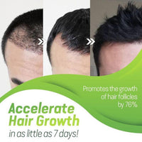 Thumbnail for 7X Rapid Growth Hair Treatment - thedealzninja