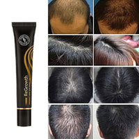 Thumbnail for Regrowth Organic Hair Serum Roller - thedealzninja