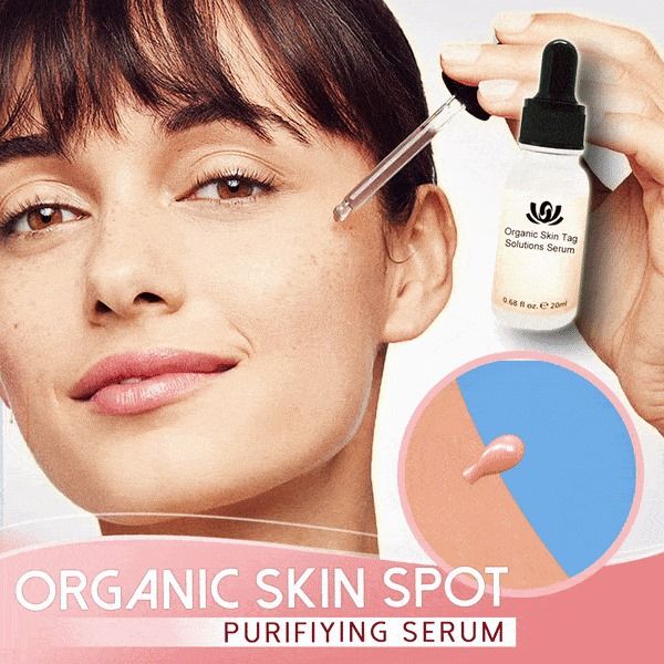 Organic Skin Spot Purifying Serum - thedealzninja