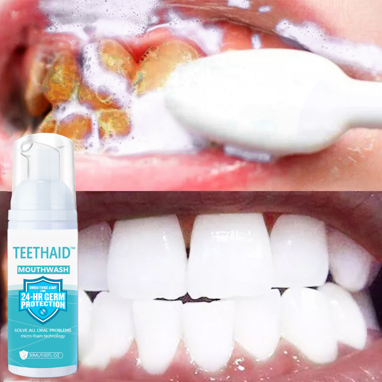 Teethaid™ Pure Herbal Teeth Whitening & Mouth Repair Mousse