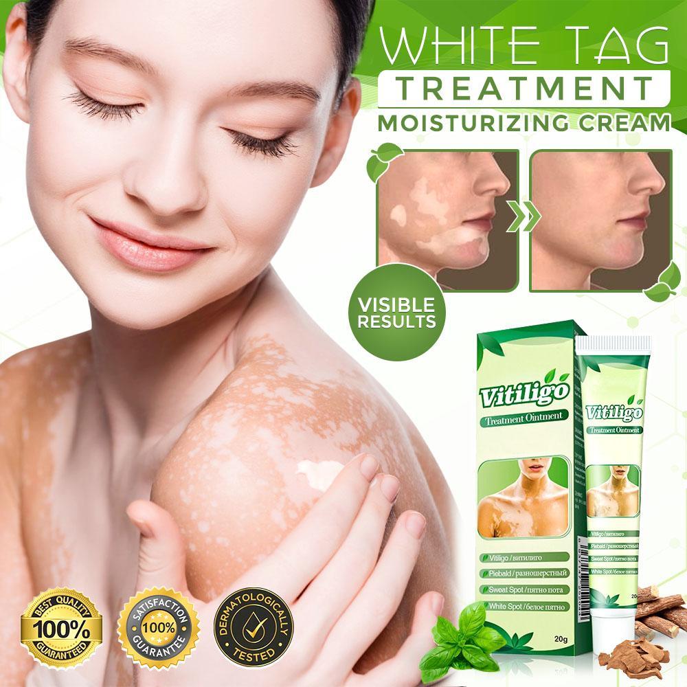 White Tag Treatment Moisturizing Cream - thedealzninja