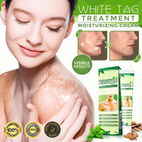 Thumbnail for White Tag Treatment Moisturizing Cream - thedealzninja